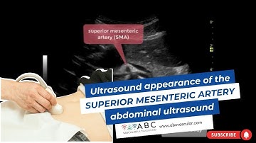 ULTRASOUND APPEARANCE OF THE SUPERIOR MESENTERIC ARTERY: ABDOMINAL ULTRASOUND