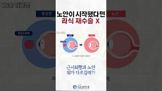 40대라면 라식 재수술을 하면 안 되는 이유