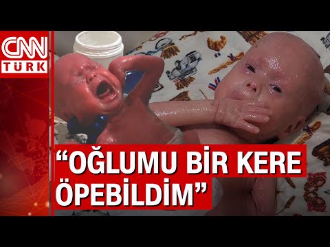 Hastalığı 300 milyonda bir görülüyor! Evlatlarına dokunamıyorlar