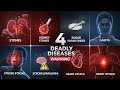 Ye 4 Bemariyan Aapko Kabhi Bhi Ho Sakti Hain |Kidney Stones Sugar Falij | Heart Attack symptoms |