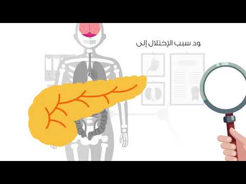 إستخدام كبسولات الخلايا الجذعية لعلاح داء السكر