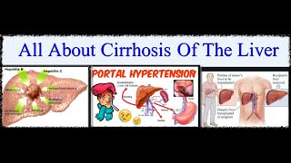 Extensive explanation about  Cirrhosis of the Liver.شرح وافى عن تليف الكبد