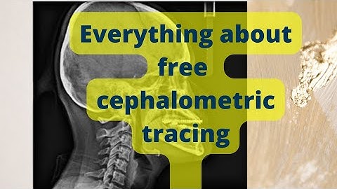 Digital cephalometric analysis  | AI based webcephX