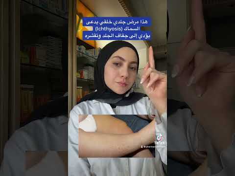 السماك الجلدي 