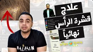 علاج القشره نهائيا أفضل شامبو للقشره والشعر الدهني للرجال وللنساء