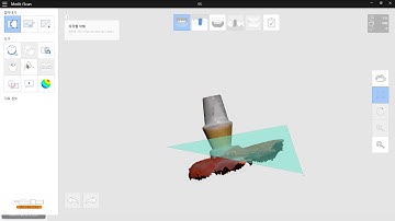 case2 #3  scan 55(diameter) stock abutment