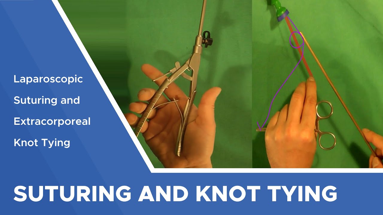 Laparoscopic Suturing and Extracorporeal Knot Tying 