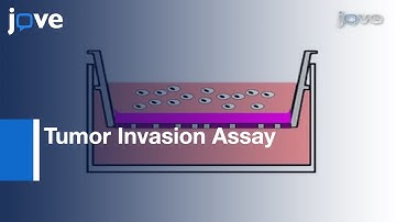 In Vitro FluoroBlok Tumor Invasion Assay l Protocol Preview