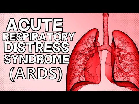 Acute Respiratory Distress Syndrome (ARDS)