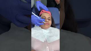 #NonSurgicalLift#GlowwithoutSurgery#Skinclinicindia#AestheticsCare#QuickGlowup