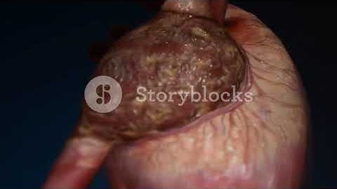 Human heart  Medical video background Motion Background