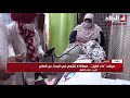 مرضى داء الفيل معاناة لا تنتهي في البحث عن العلاج شاهد