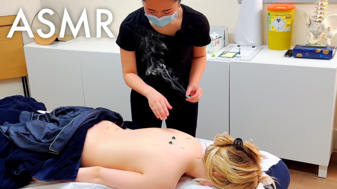 ASMR Moxibustion, Acupuncture, Cupping Compilation (Unintentional, real person asmr)