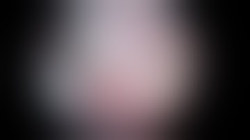 Superior Capsular Reconstruction