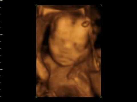nottingham university hospital cqc Window to the womb 4D baby scan of debbie and tony