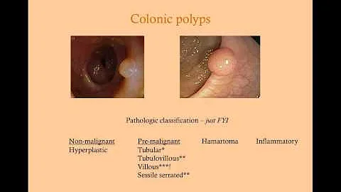Colon Disorders and Surveillance - CRASH! Medical ...