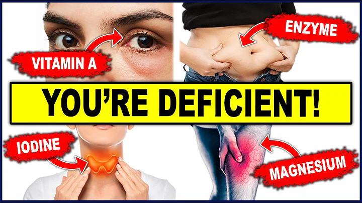 10 Signs Your Body Is Deficient in Nutrients