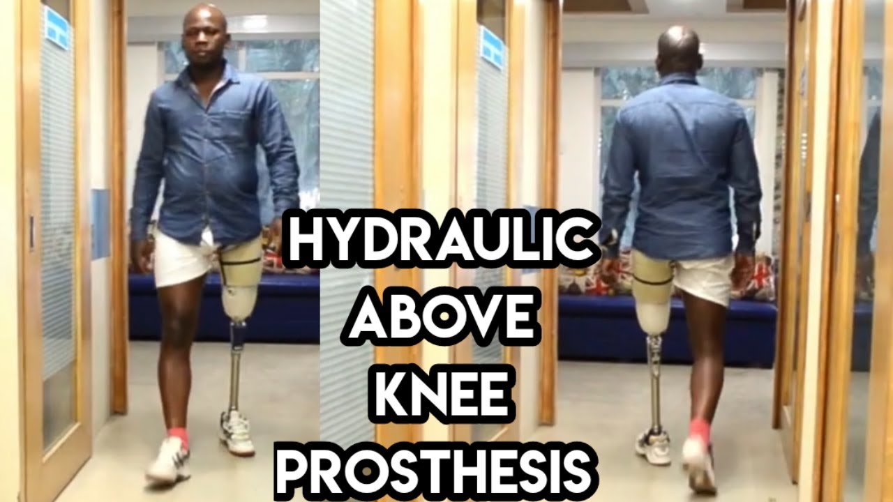 Hydraulic Above Knee Prosthesis Artificialleg limb