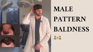 Male Pattern Baldness and Hair Restoration