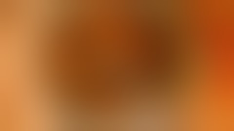 Marfans Iris Fixation