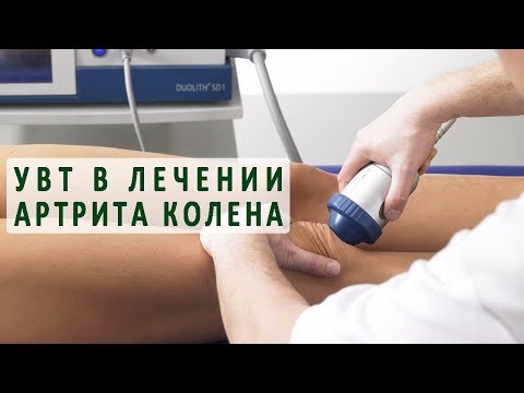 Лечения артрита коленного сустава с помощью ударно-волновой терапии (УВТ)