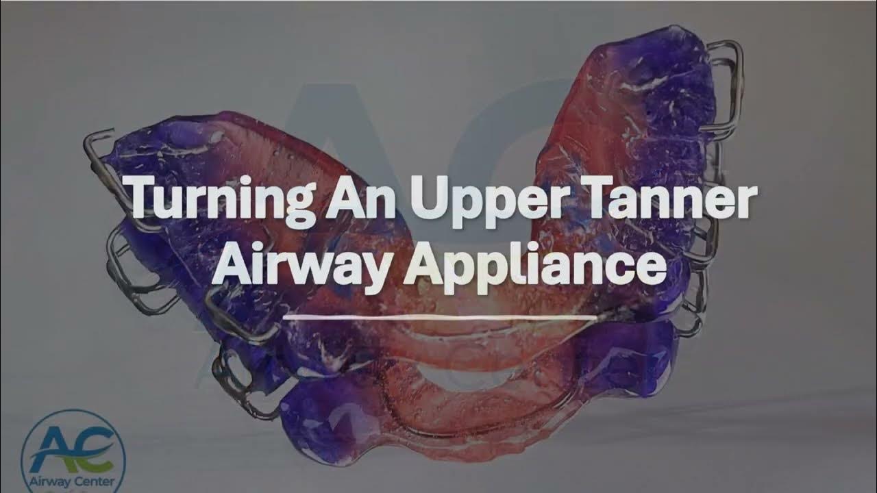 Turning the Key on a Tanner Airway Appliance YouTube