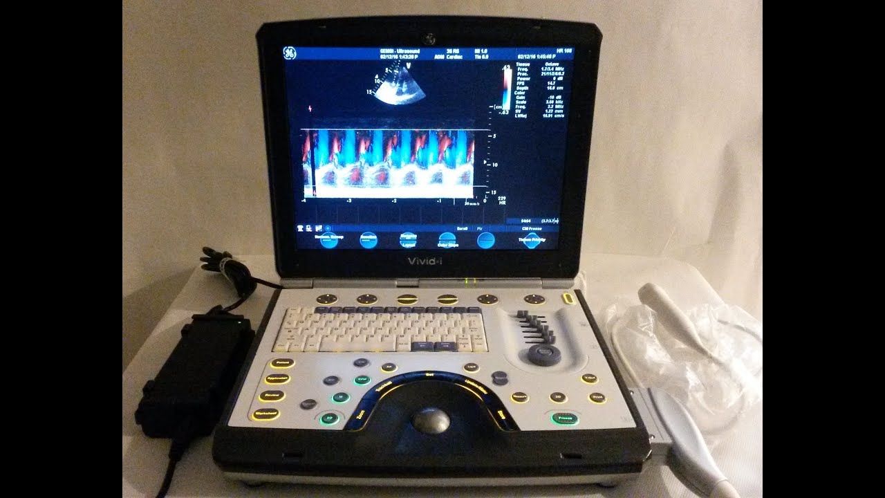 Used GE Vivid i with a 3S-RS Cardiac Probe.mp4