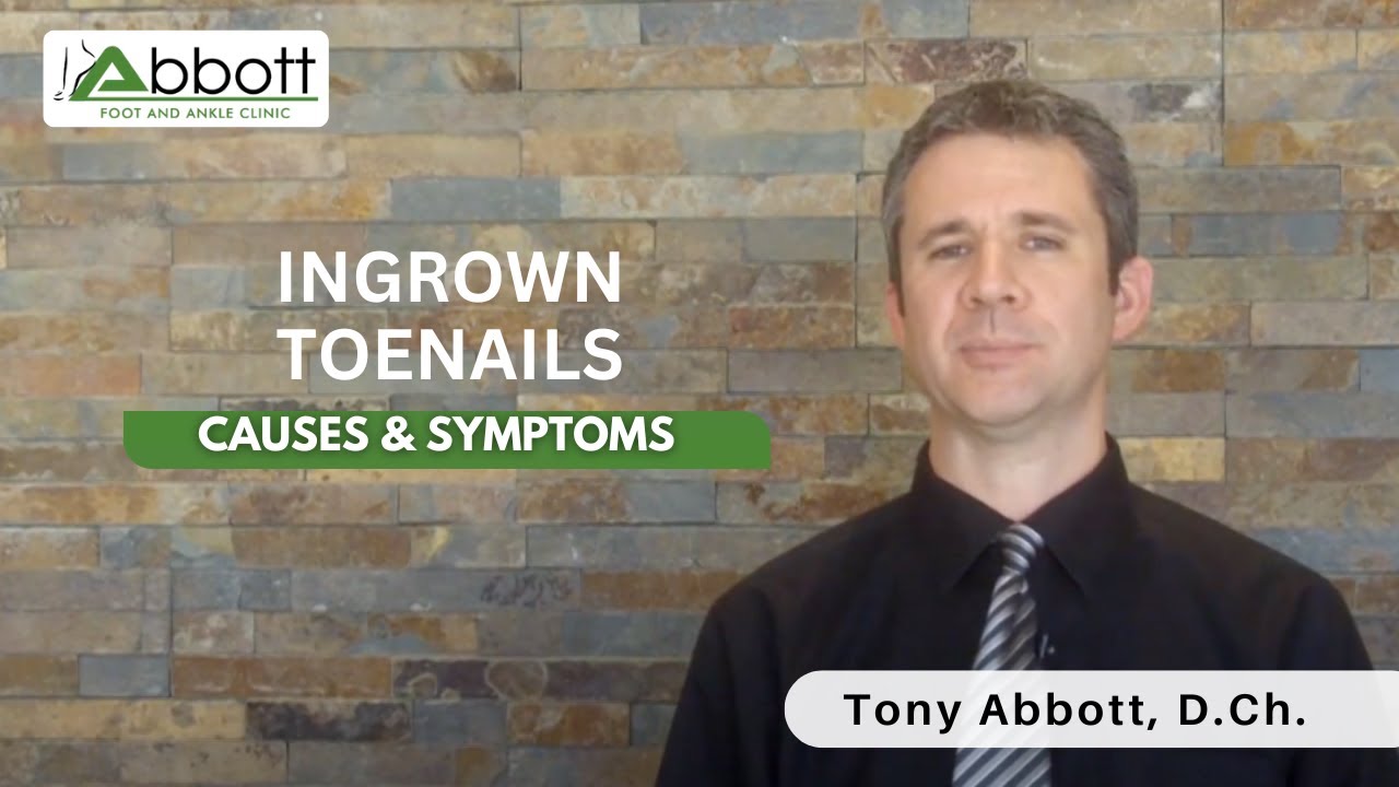 What Causes Painful Ingrown Toenails?