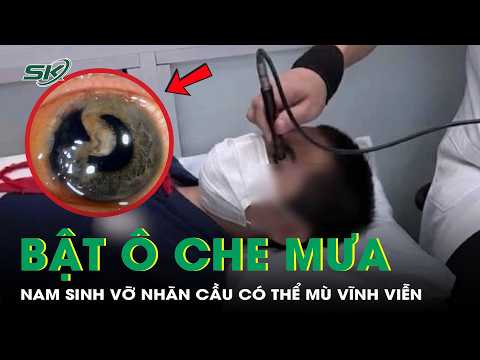Classmate opens umbrella in rain, 13-year-old boy suffers ruptured eyeball and faces potential pe...