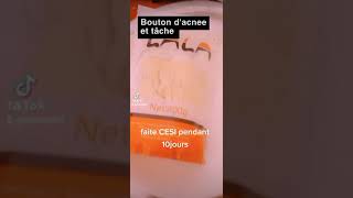 Anti-bouton d'année ,les tâches etc......