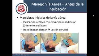 Vía Aérea en Urgencias - Parte 1 (Aproximación y Manejo Inicial)