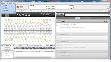 CS R4+ 2 Minute Training: Printing a treatment plan