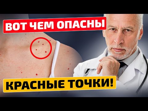 Никогда бы не подумал, что все так серьезно! Красные точки на коже