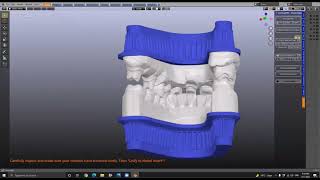ZOOM Session  - VertXsplit Model System