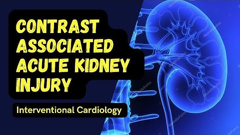 Contrast induce acute kidney injury review