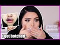 Story Time GRWM | My horrific lip injections experience