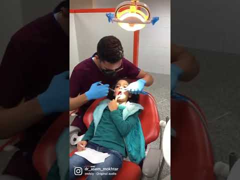 علاج الاطفال لازم يكون بطريقة تحبب الاطفال ف زيارة طبيب الاسنان
