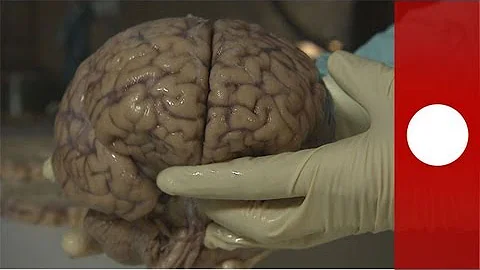 ¿De qué está hecho el cerebro?