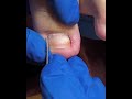 Satisfying feet cleaning | Gentle Foot Care Routine #fypシ #cleannails #RelaxingCare #fypシ