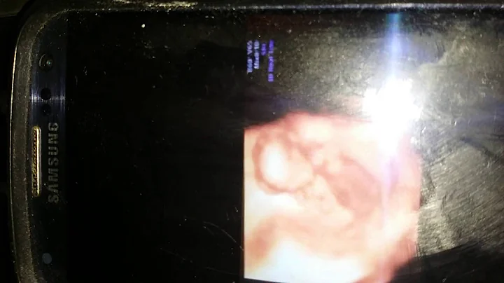 Baby Boy Chaney 2016