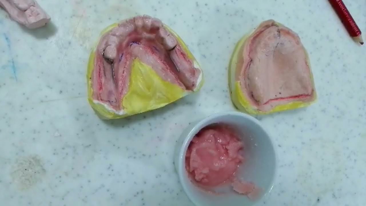 المرحلة (2) التأصيل العلمي صنع صفيحة قاعدية و ارتفاع شمعي base plate &bite rim أ.عمار الجهماني