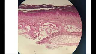 Thick Skin And Scalp Lab