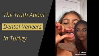 The Truth about Dental Veneers in Turkey