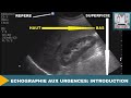 Echographie aux urgences introduction