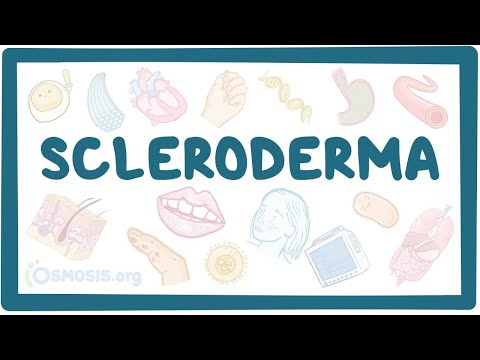 Video: Wat is juveniele sclerodermie?