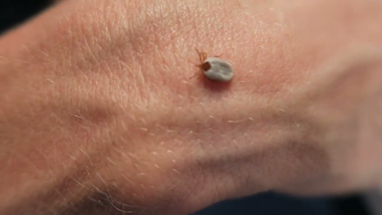 What Does a Paralysis Tick Look Like? YouTube