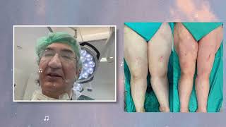 Vaser Liposuction ile  Yağ Alımı, Bacak İnceltme✔️
