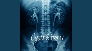 Cysts and Stones