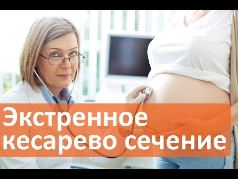 Будущие мамы, узнайте каковы экстренные показания к кесареву сечению. Кесарево в Мать и дитя.