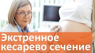 Будущие мамы, узнайте каковы экстренные показания к кесареву сечению. Кесарево в Мать и дитя.